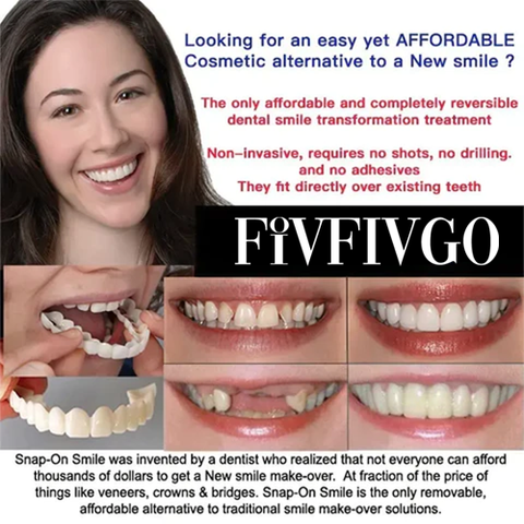 Snap-On Smile – Get Your Perfect Smile Instantly! - YN