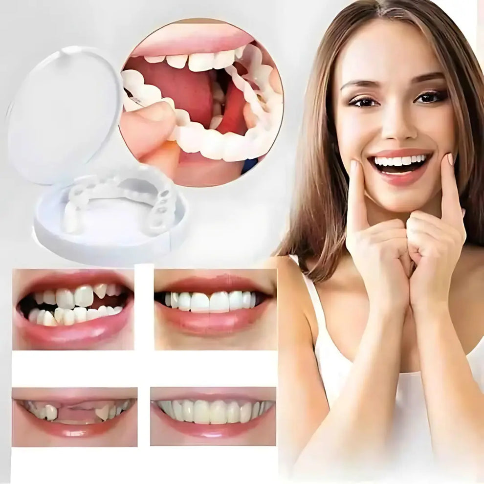 Snap-On Smile – Get Your Perfect Smile Instantly! - YN