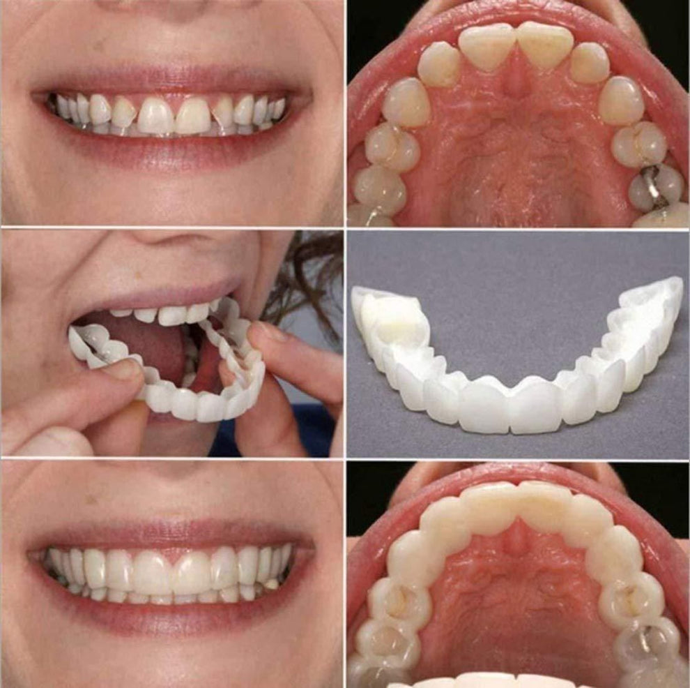 Snap-On Smile – Get Your Perfect Smile Instantly! - YN