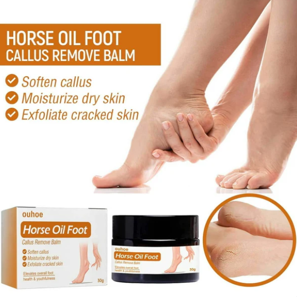 Horse Oil Foot Callus Remedy Balm - YN